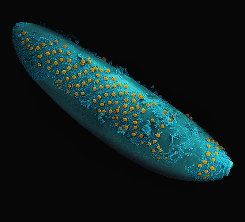 A microscopic image of a blue mosquito egg with yellow dots that are tubercles.