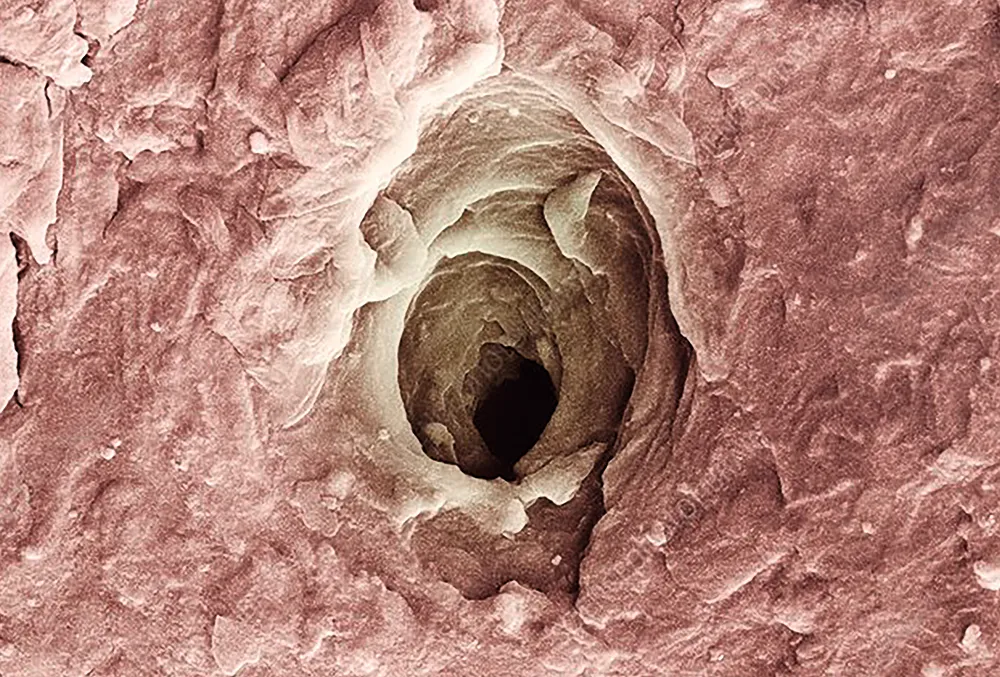 Why is human skin so rubbish? © Science Photo Library Why is human skin so rubbish? © Science Photo Library